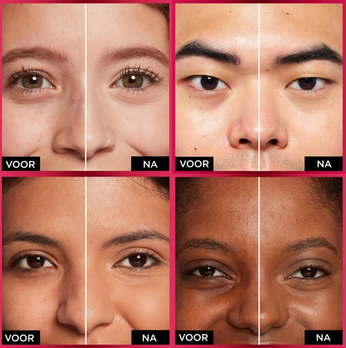 L'Oréal Paris - Infaillible More Than Concealer - 328.5 Crème Brûlée -Langhoudende Concealer Met Een Hoge Dekking - 11ml 4 L'Oréal Paris - Infaillible More Than Concealer - 328.5 Crème Brûlée -Langhoudende Concealer Met Een Hoge Dekking - 11ml - Afbeelding 2