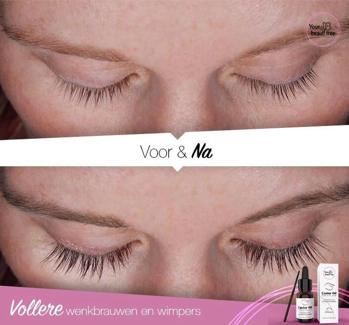 Your Beauty Tree ® Wimper Serum Met Echte Castor Olie |100% Natuurlijke Wimpergroei| Castor Oil Eyelash Serum|Wonder Olie | Wimper Groei | Wenkbrauw Serum | Lash Serum | Wimper Groeimiddel 6 Your Beauty Tree ® Wimper Serum Met Echte Castor Olie |100% Natuurlijke Wimpergroei| Castor Oil Eyelash Serum|Wonder Olie | Wimper Groei | Wenkbrauw Serum | Lash Serum | Wimper Groeimiddel - Afbeelding 4