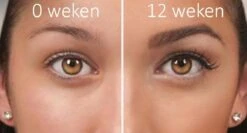 100% Natuurlijke Groei - Wenkbrauwserum - Vollere Wenkbrauwen - Castor Olie - Wenkbrauw Serum - 10ML -Cosmetica Promotiewinkel 1200x645