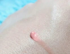 Biodermal Sun Lipbalm SPF25 - Tube 12 Ml - Natural Pink - Lippenbalsem -Cosmetica Promotiewinkel 1200x927 2